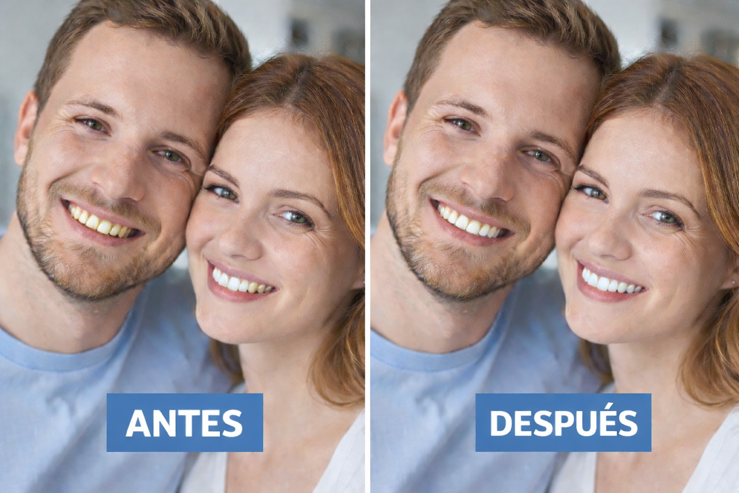 TENLOYA - Okeny’s Lápiz Sonrisa Blanca 1Un